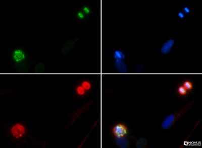 Immunocytochemistry/Immunofluorescence: Histone H4 [p Ser1] Antibody [NB21-2000] - Histone H4 pS1 antibody was tested in in nonmitotic, prophase, and telophase HeLa cells with FITC (green). Nuclei and alpha-tubulin were counterstained with Dapi (blue) and Dylight 550 (red).